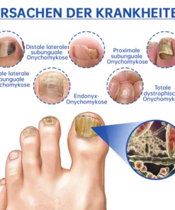 Furzero™ PureNail Pilz-Lasertherapiegerät