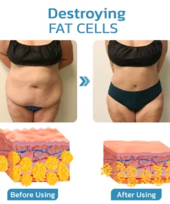 Furzero™ Slendery Ultrasonic Lymphatic Massager