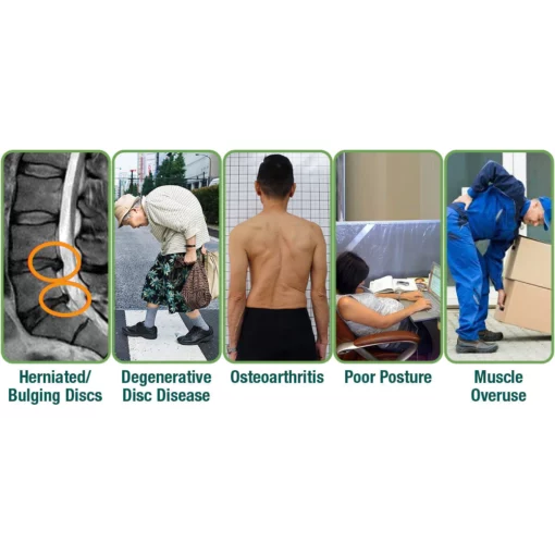 لاصقة التثبيت العشبية GFOUK™ LumbarFlex
