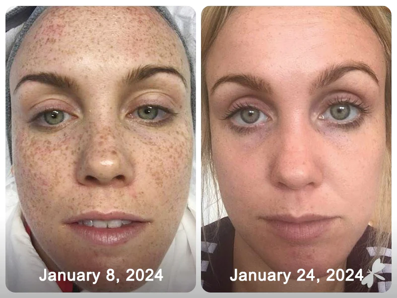 GFOUK™ Melanin Facial Correcting Essential Oil 