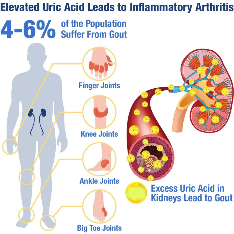 GFOUK™ UricEase Microcurrent Therapy Na'urar