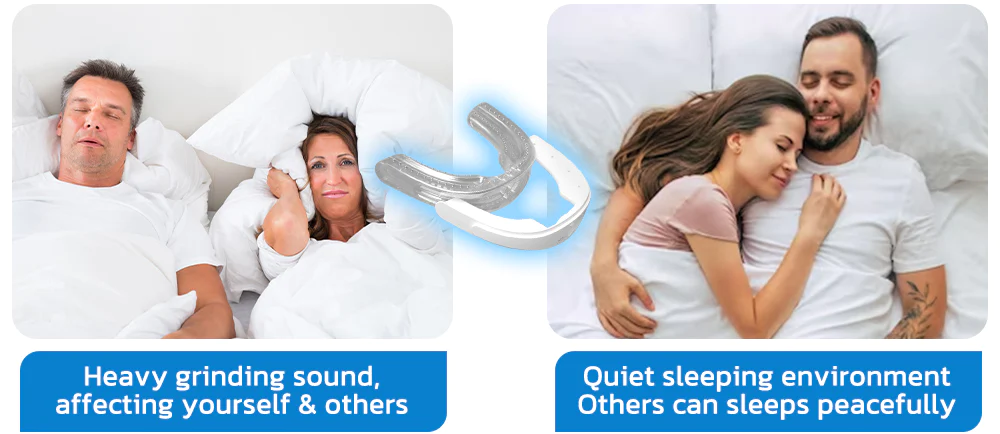 GFOUK™ WellSleep Apnea Oral Appliances