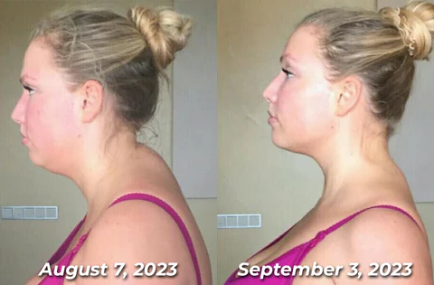 GFOUK™ HumpEase Bee Venom Smoothing Plaster