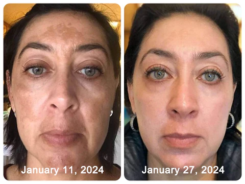 GFOUK™ Melanin Facial Correcting Essential Oil<br />