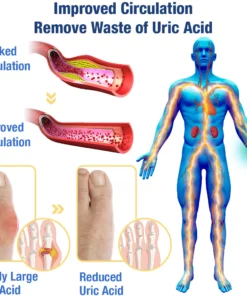 GFOUK™ UricEase Microcurrent Therapy Device