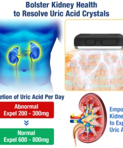 GFOUK™ UricEase Microcurrent Therapy Device