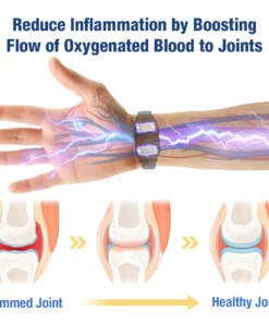 GFOUK™ UricEase Microcurrent Therapy Device