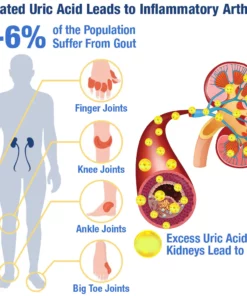 GFOUK™ UricEase Microcurrent Therapy Device