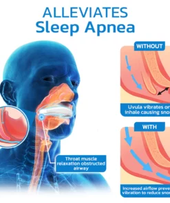 GFOUK™ WellSleep Apnea Oral Appliances