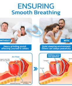 GFOUK™ WellSleep Apnea Oral Appliances