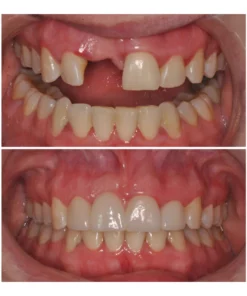 Guru™ OralCare CocoBiotics Pulling Oil