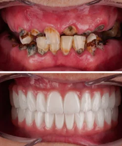 Guru™ OralCare CocoBiotics Pulling Oil