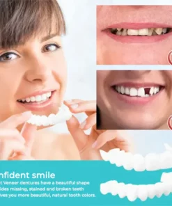 HONXI™ Adjustable snap-on prosthesis