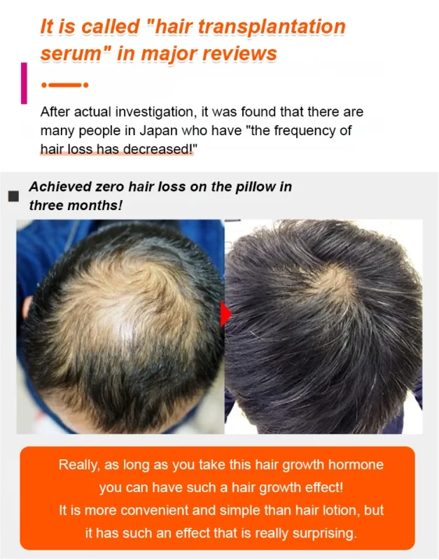 Hair Growth Serum