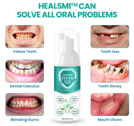 HealSmi™ TEETH Mouthwash - Menyelesaikan semua Masalah Mulut