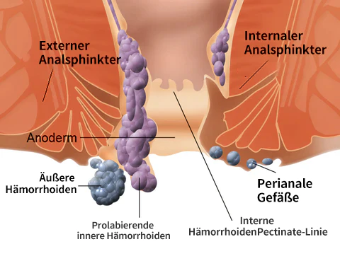 Hemocare™ Pflanzliche Stärke Hämorrhoiden-Kapseln
