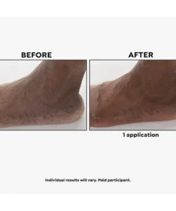 Imperial Honey Deluxe 2-piece Kit