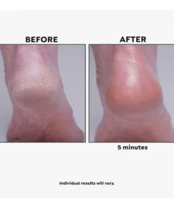 Imperial Honey Deluxe 2-piece Kit