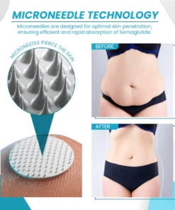 InsuBal™ Semaglutide Microneedle Patches