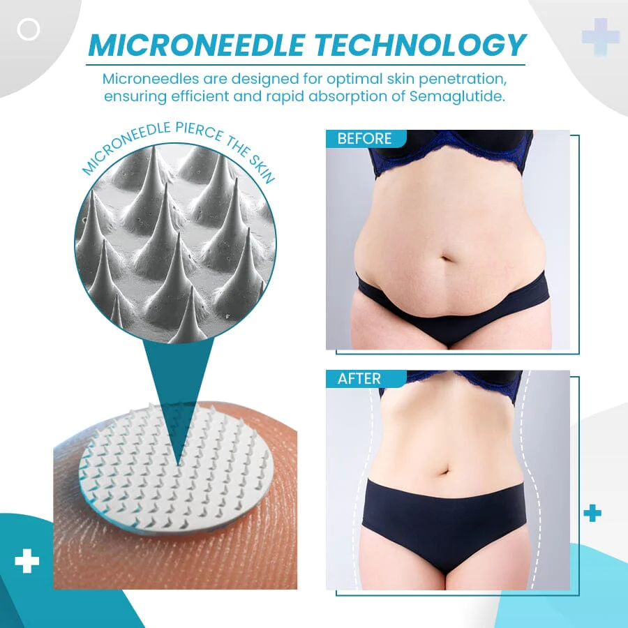 InsuBal™ Semaglutide Microneedle Patches
