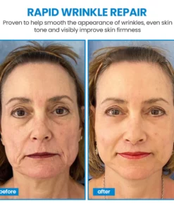 KISSHI™ Botox Facial Essence