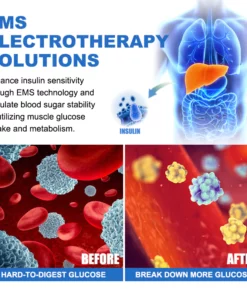 KISSHI™ GlycoWave Blood Sugar Control Device