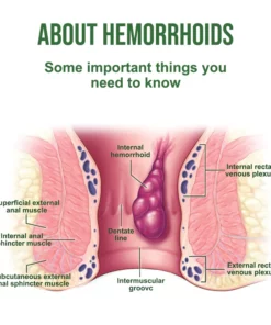 KISSHI™ Hemorrhoidal Ointment