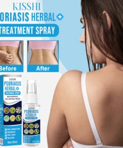 KISSHI™ Psoriasis Herbal Treatment Spray