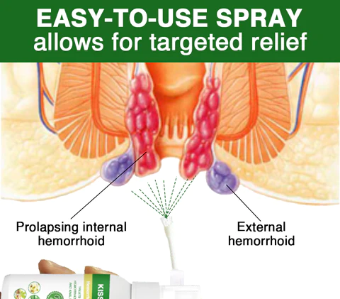 Kisshi™ Hemorrhoid Spray