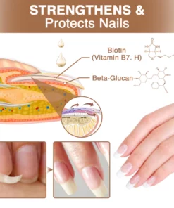 Kisshi™ OnycholysisHeal Nail Strengthening And Growth Conditioner