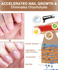 Kisshi™ OnycholysisHeal Nail Strengthening And Growth Conditioner