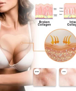 Kisshi™ RevitaChest Smoothing Treatment Patch