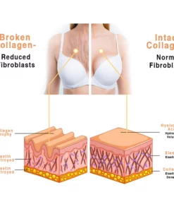 Kisshi™ RevitaChest Smoothing Treatment Patch