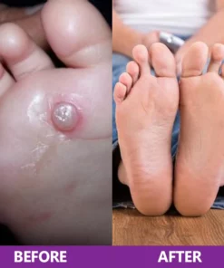 LIMETOW™ Foot Cleansing and Bacteriostatic Spray