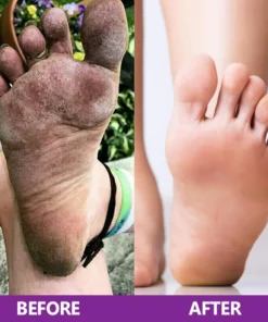 LIMETOW™ Foot Cleansing and Bacteriostatic Spray