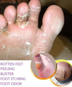 LIMETOW™ Foot Cleansing and Bacteriostatic Spray