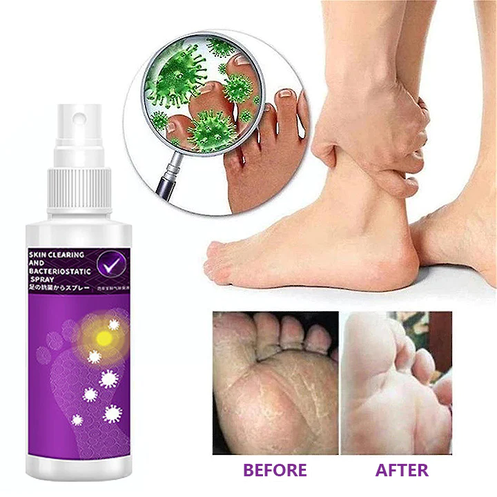 LIMETOW™ Foot Cleansing and Bacteriostatic Spray