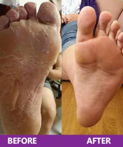 LIMETOW™ Foot Cleansing and Bacteriostatic Spray