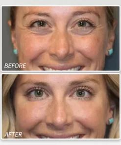 LIMETOW™ Instant Eye Cream Tightener