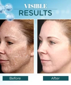 Lanthome™ Triple-Active Brightening Dark Spot Remover