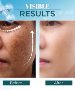 Lanthome™ Triple-Active Brightening Dark Spot Remover