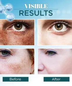 Lanthome™ Triple-Active Brightening Dark Spot Remover