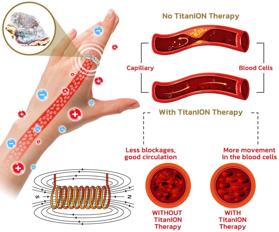 แหวนเพชรมอยส์ซาไนท์ Lenreey™ Magnetology