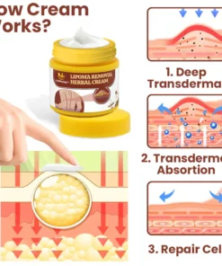LumpGone™ Lipoma Removal Herbal Cream