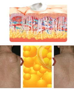 LumpGone™ Lipoma Removal Herbal Cream