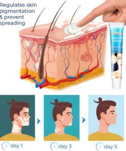 MelFix™ Vitiligo Therapy Cream