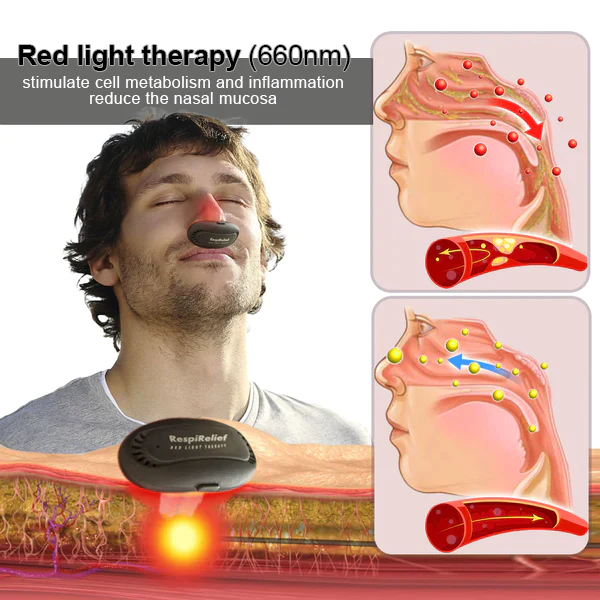 Nurbini™ RespiRelief red light nasal therapy device
