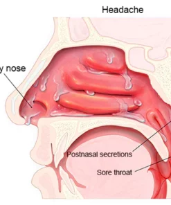 Nurbini™ RespiRelief red light nasal therapy device