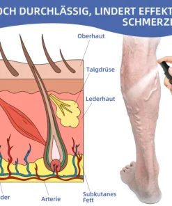 Ourlyard ™ Medizinisches VenenEase Therapie spray
