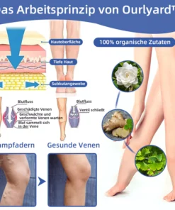 Ourlyard ™ Medizinisches VenenEase Therapie spray